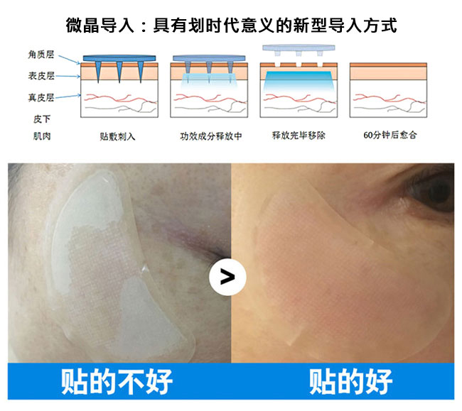 高教授微晶祛斑